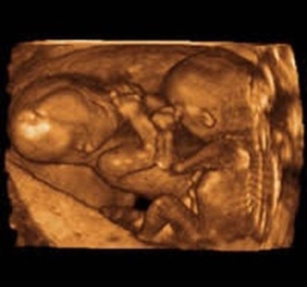 3D Prenatal
