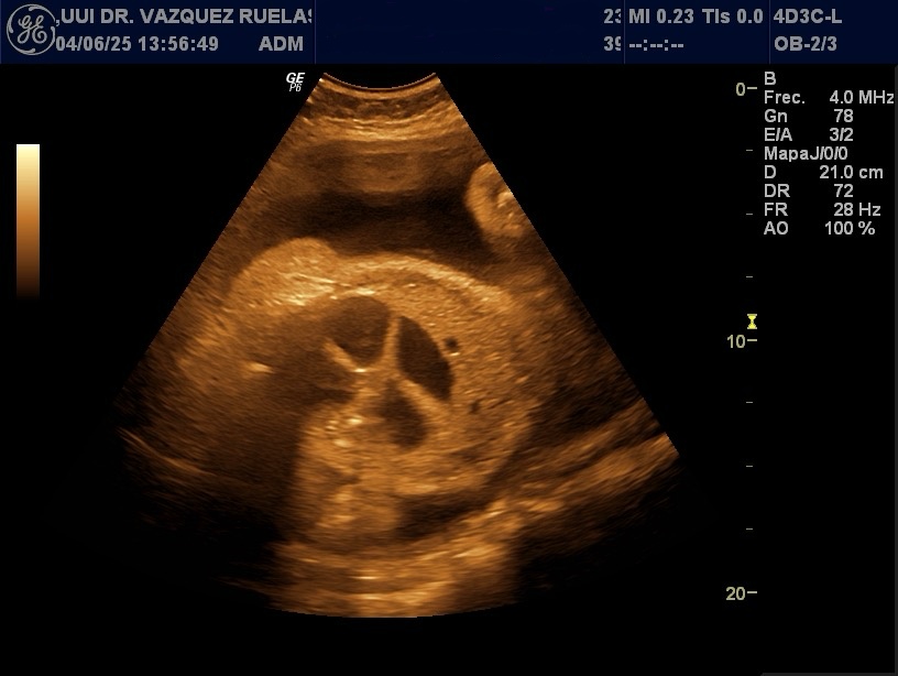Abdominal
